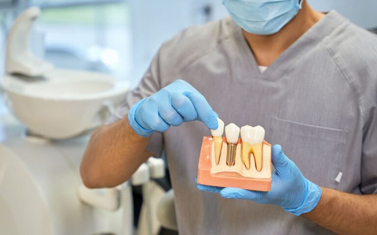 a person holding a model of teeth at klinik gigi kota bharu, amal medik