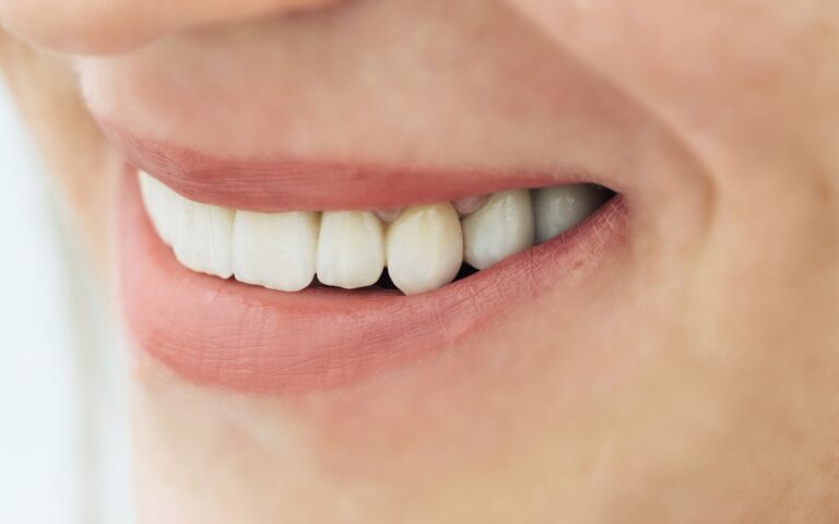 close up of a person's mouth at klinik gigi kota bharu, amal medik