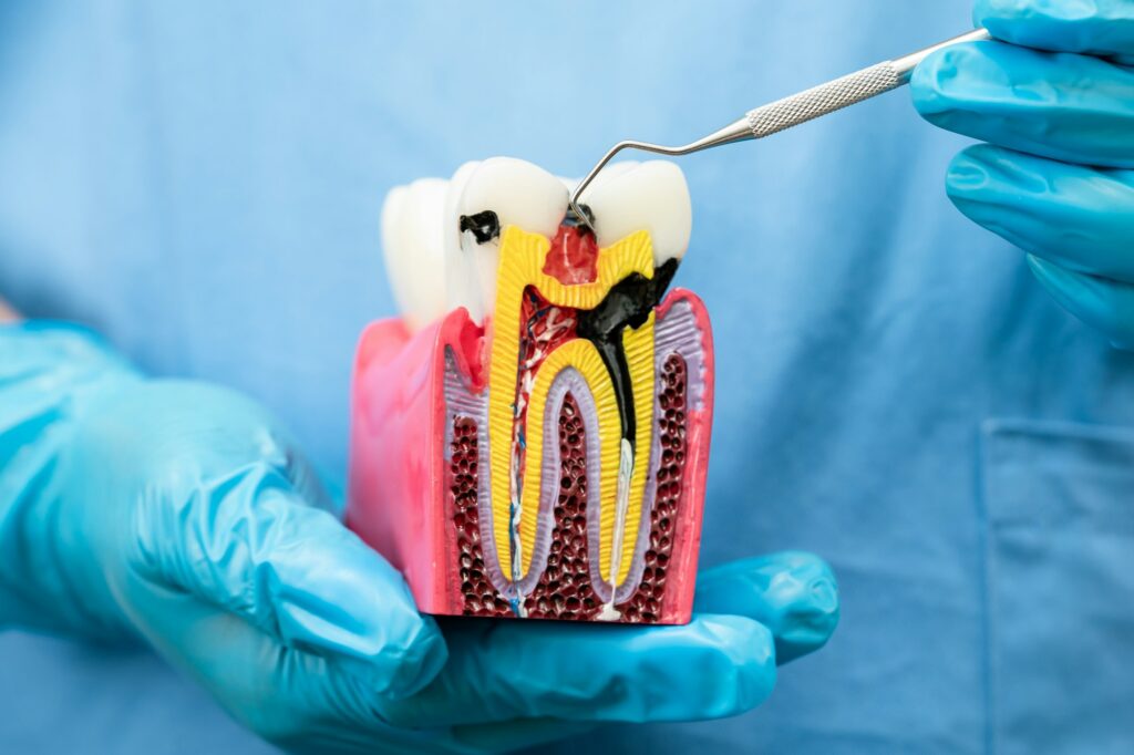 Asian dentist holding dental implant, artificial tooth roots into jaw, root canal of dental